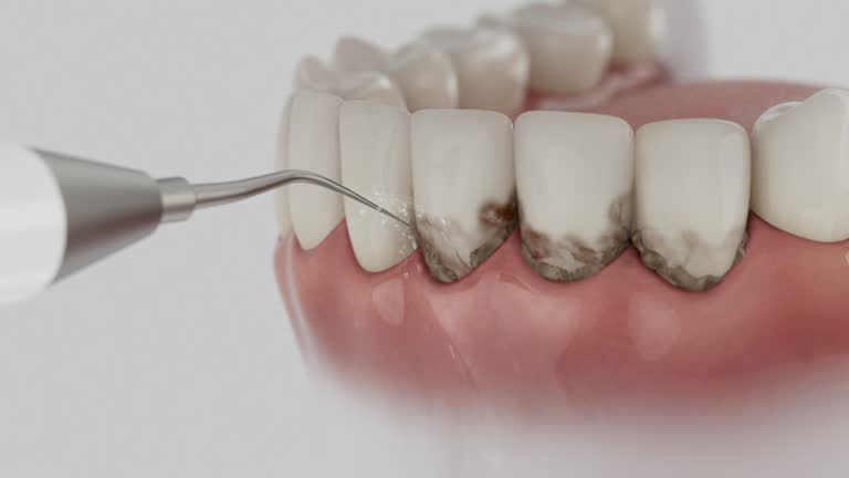 Reliable Dental Implants contractor in Paramount-Long Meadow, MD by Smile Center Dentistry
